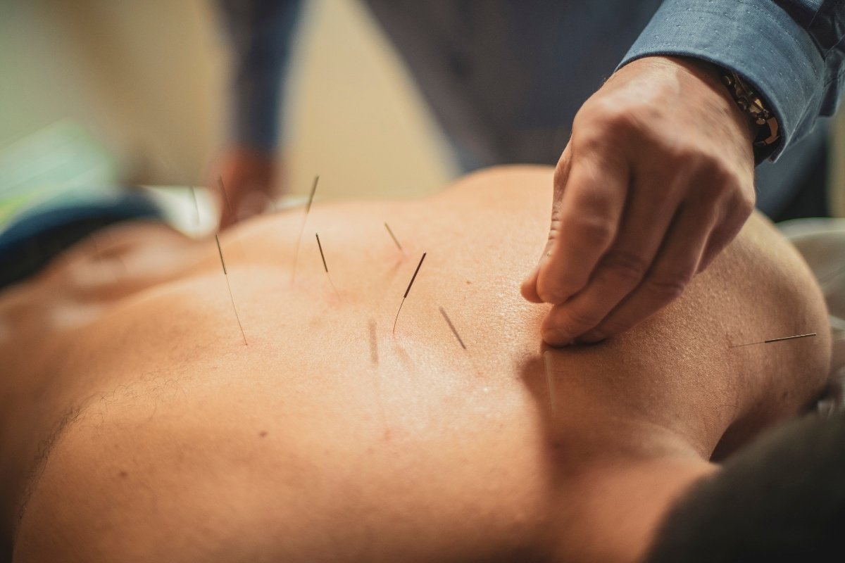 Acupuncturists